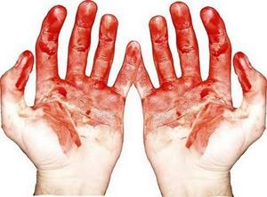 Кровь на руках