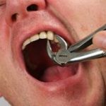 Что значит по соннику вырвать зуб без крови