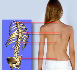 Болезнь спины
